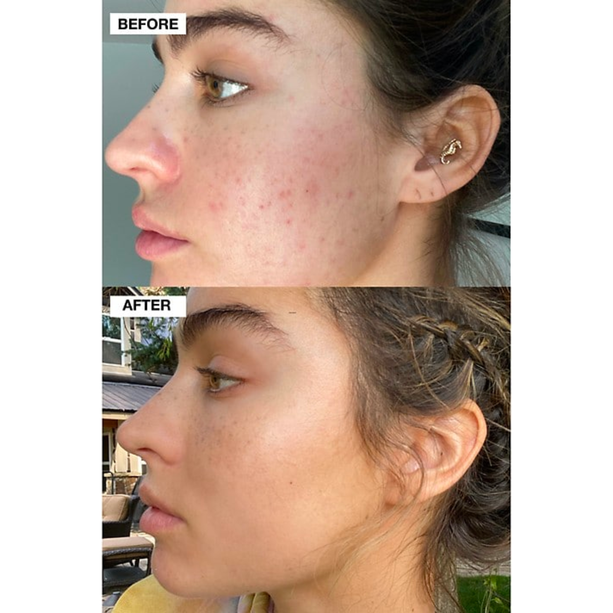 Beauty Glow Skincare Gummies - 60s